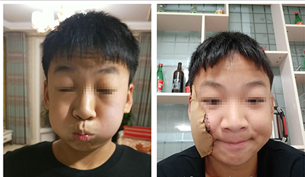 康复案例(图1)